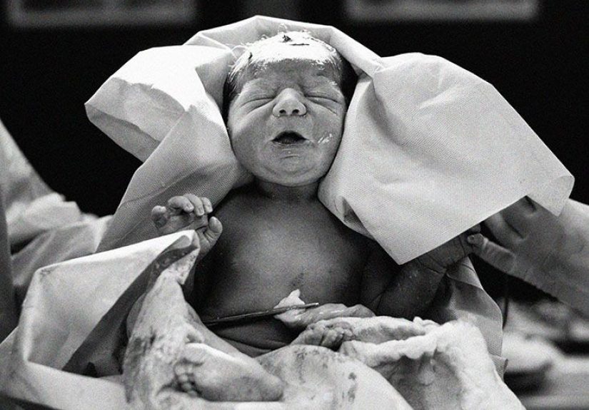 C-section: What to Expect, and 9 Tips for a Faster Recovery