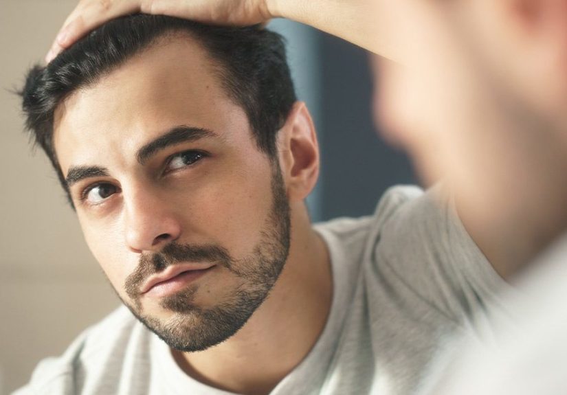 Hairline Restoration: What You Can Do Now