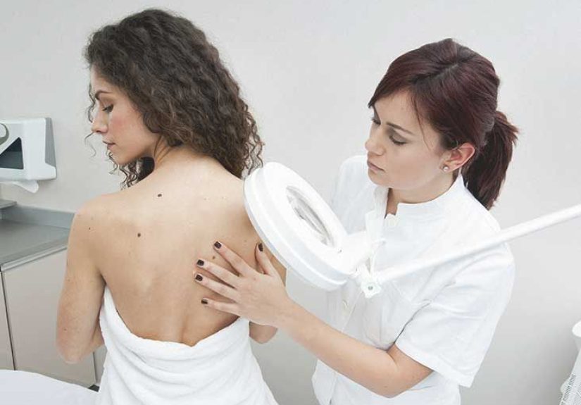 Sweet Syndrome: Definition, Prevention, and Treatment