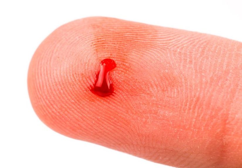 Bleeding Time Test: Purpose, Procedure, and Risks
