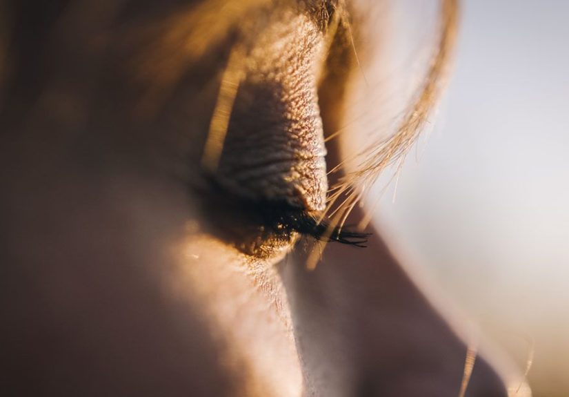 Eyelid Sunburn: Symptoms and Treatment