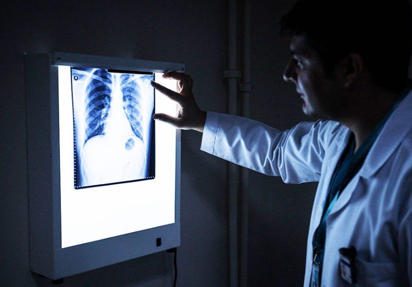 Is emphysema hereditary? Genetics, testing, and more