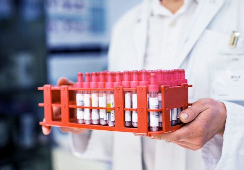 Macrothrombocytopenia: Causes, Symptoms, and Treatment