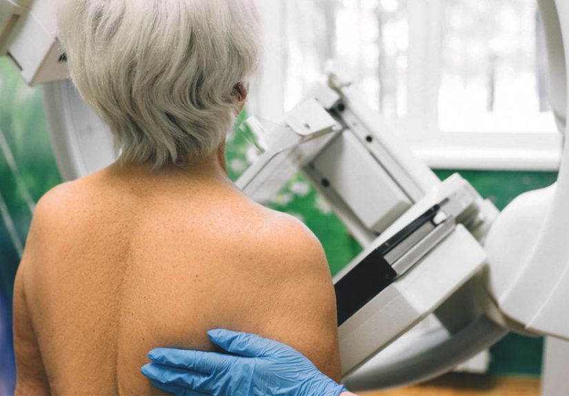 Medicare and Mammograms: Coverage, Cost, and Types