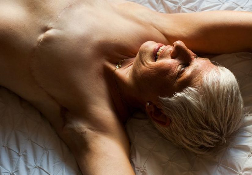 Surgery for Breast Cancer