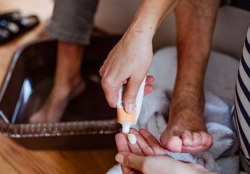 The Stages of Nail Fungus: Symptoms, Risk Factors, and More