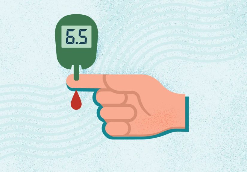 Type 2 Diabetes: Symptoms, Causes, Diagnosis, Treatment, and Prevention