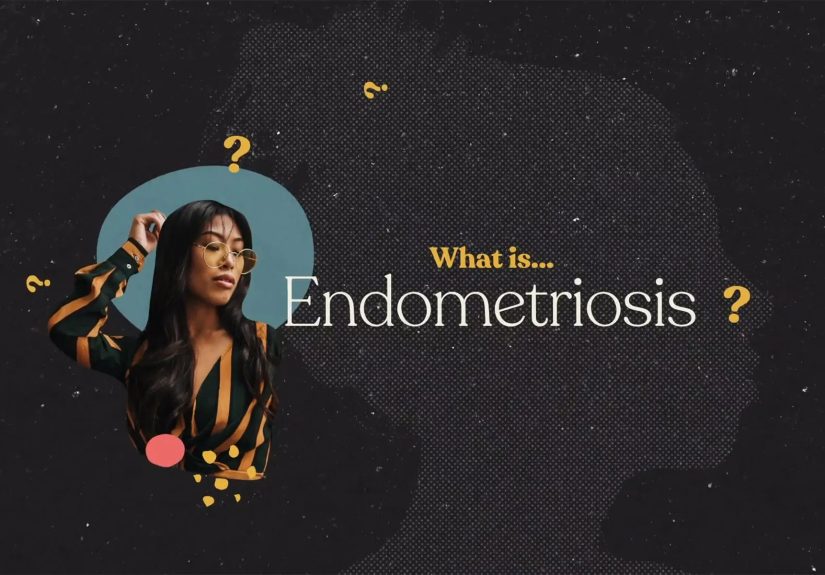 What Is Endometriosis?