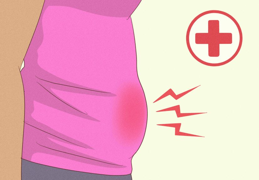 17 Ways to Cure Stomach Bloating