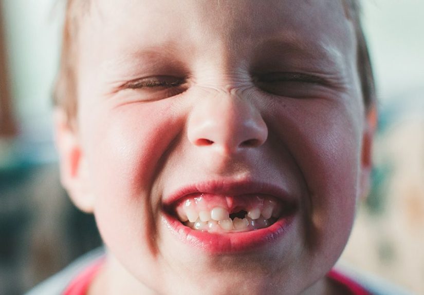 Deciduous Teeth - Also Known as Primary or Baby Teeth