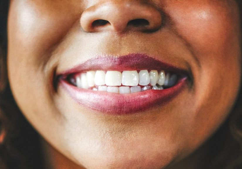 How to Clean Retainers: Tips and Tricks
