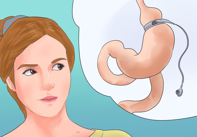 How to Diagnose Pancreatic Cancer: 14 Steps