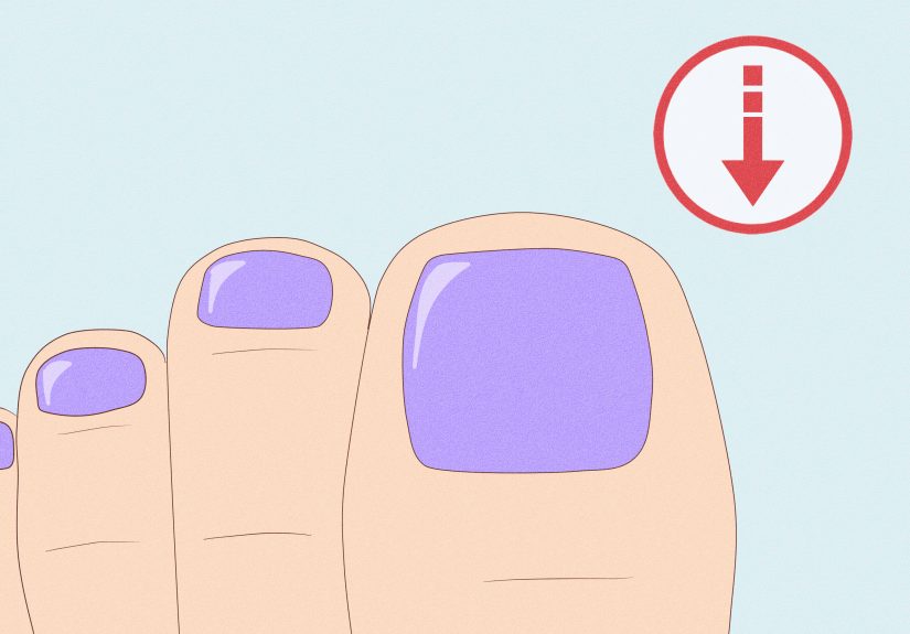 How to Fix a Split Toenail: Causes, Treatments, & More