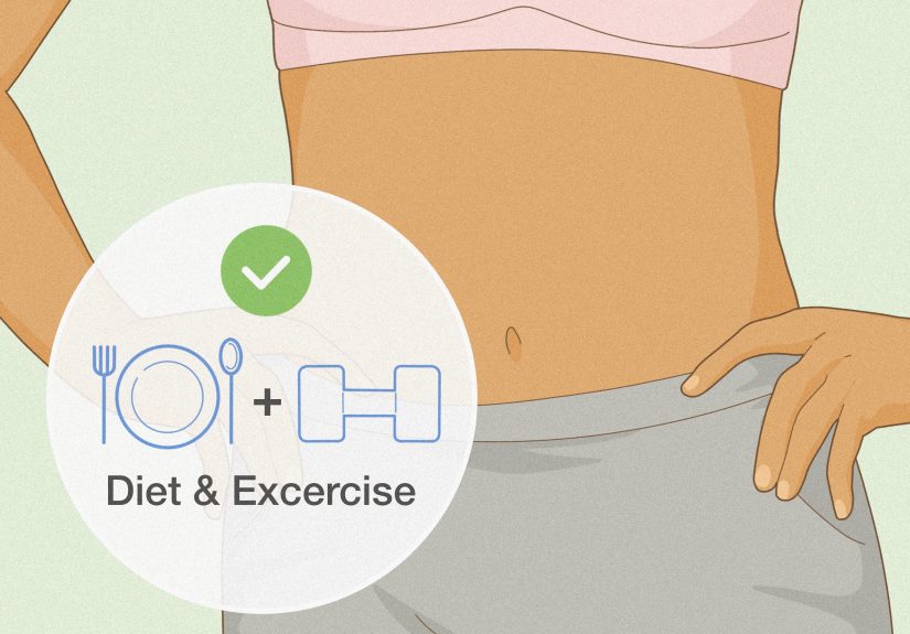 How to Get Rid of Upper Stomach Fat & Keep It Away