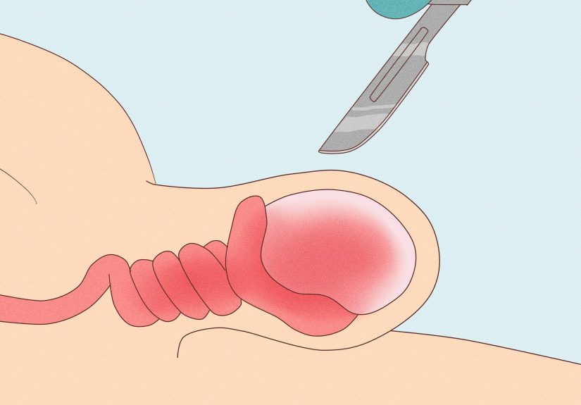 How to Relieve Testicle Pain: Causes, Treatments & More