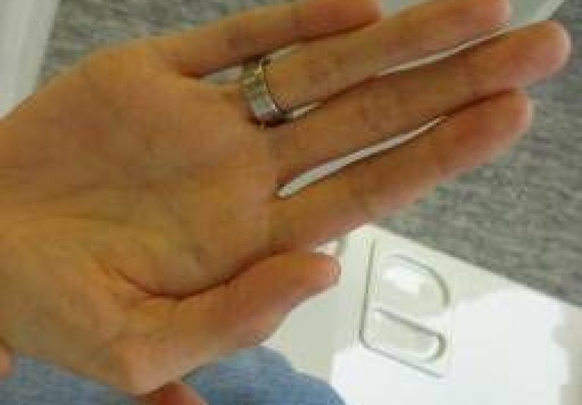 Marfan syndrome: Symptoms, causes, and diagnosis