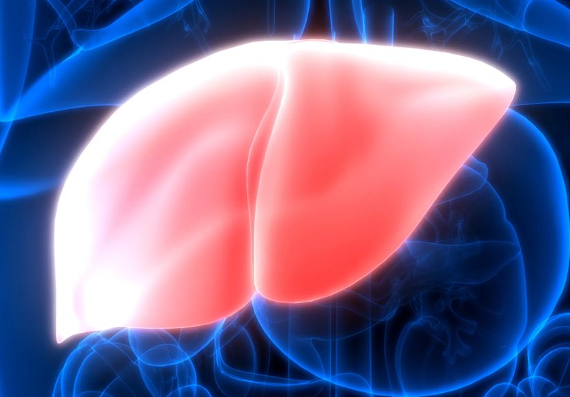Metabolic dysfunction-associated steatohepatitis (MASH): What to Know