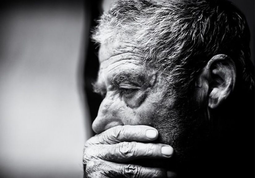 MSA Parkinsonian type: Symptoms, treatment, and outlook