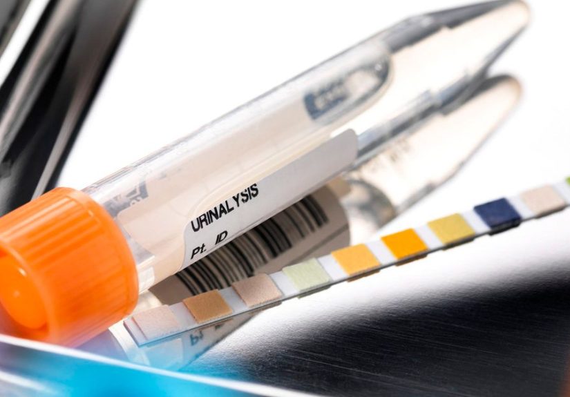 pH Imbalance: Acidosis, Alkalosis, Diagnosis, and Treatment