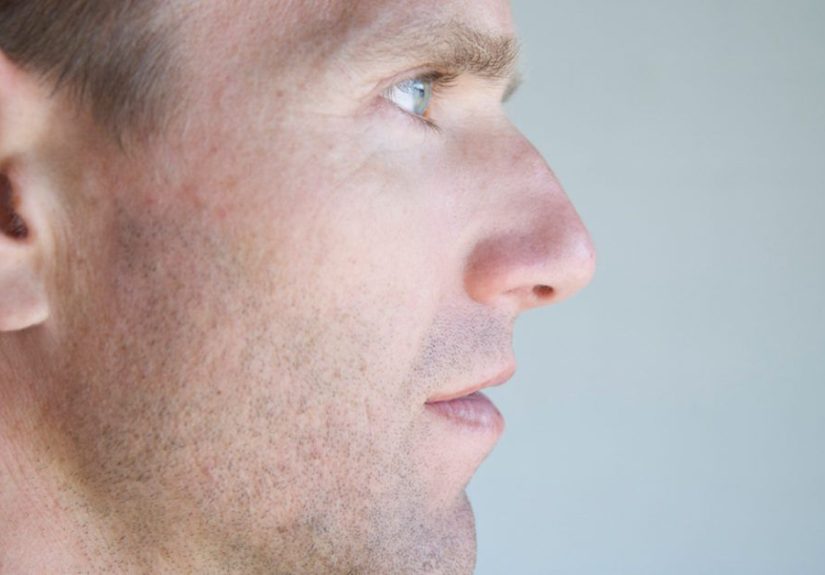Septoplasty: Procedure, Risks, and Recovery