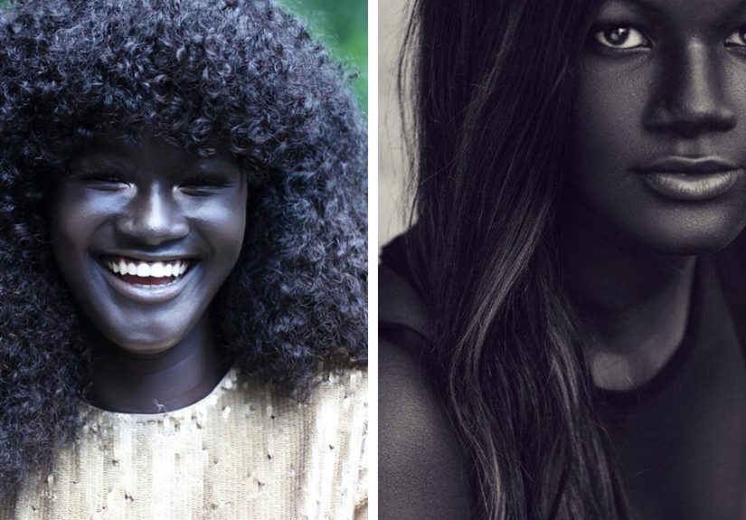 Teen Bullied For Her Dark Skin Color Becomes A Model