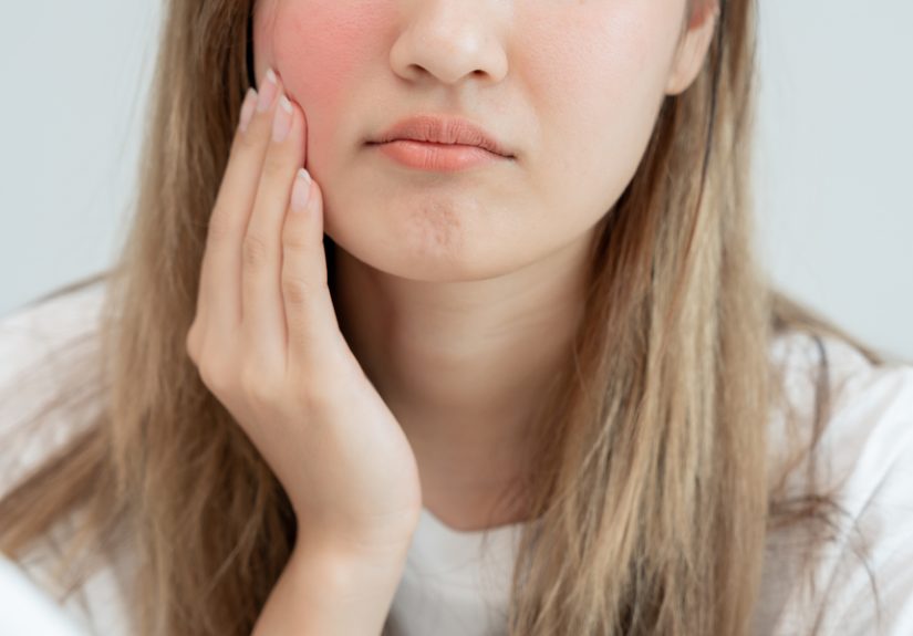 12 Hidden Rosacea Triggers, According to Dermatologists