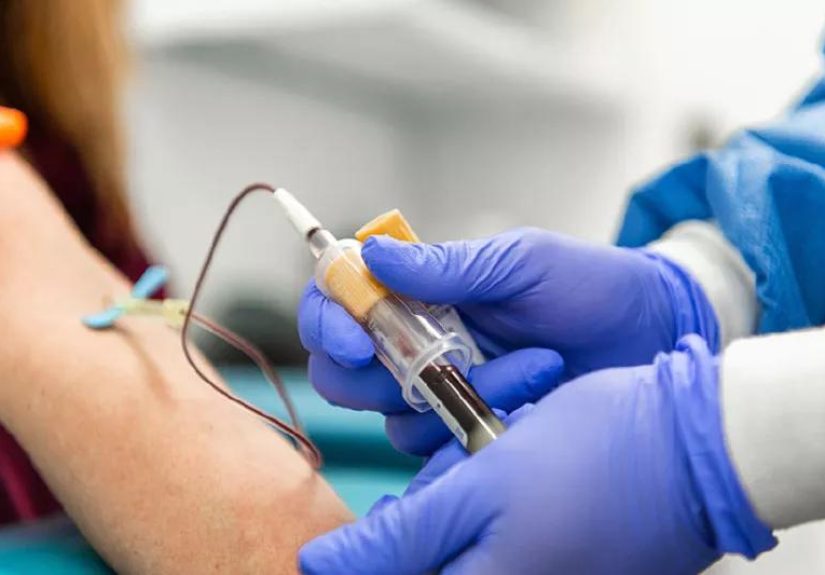 Are Rheumatoid Arthritis and Anemia Connected?