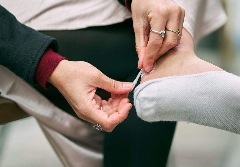 Blisters: Pictures, Causes, and Outlook