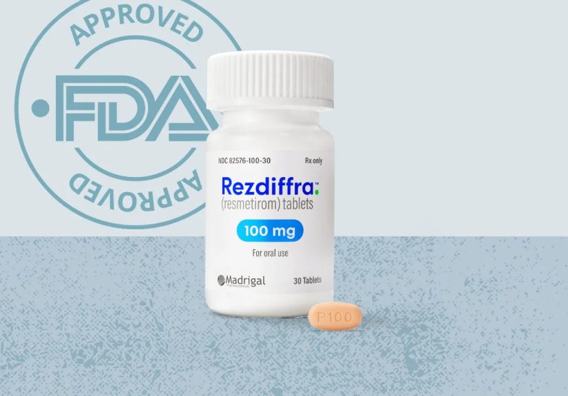 FDA Approves Rezdiffra (Resmetirom) for Fatty Liver Disease NASH (Also Known as MASH)