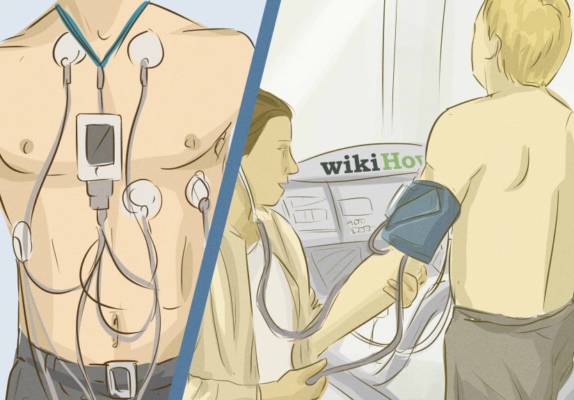 How to Prepare for an ECG: 8 Steps