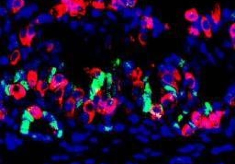 Insulin-producing mini-stomachs: a game-changer for diabetes?