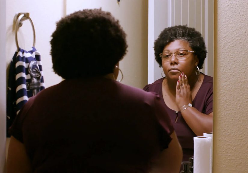 Psoriasis on Darker Skin and Advocating for a Diagnosis