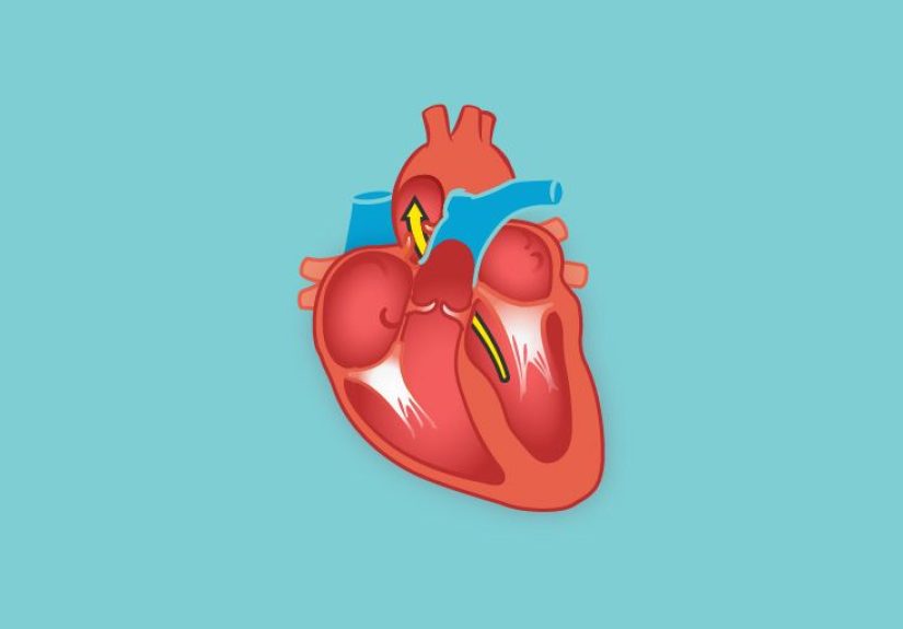 Right Atrium Function, Definition & Anatomy