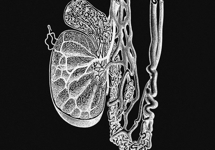 Spermatocele: What It Is, Causes, Treatments
