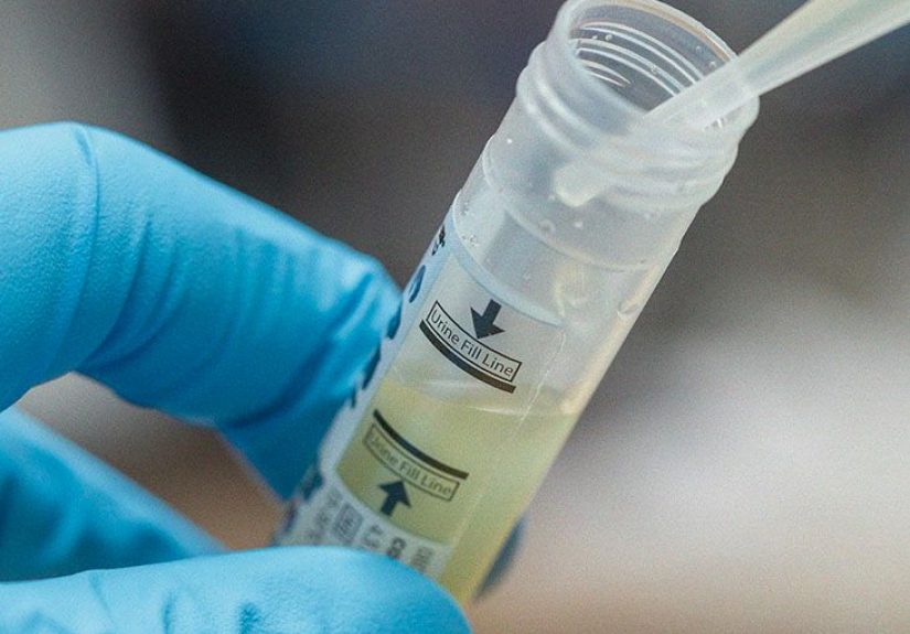 STIs and Cervical Cancer: Which Ones Increase the Risk?