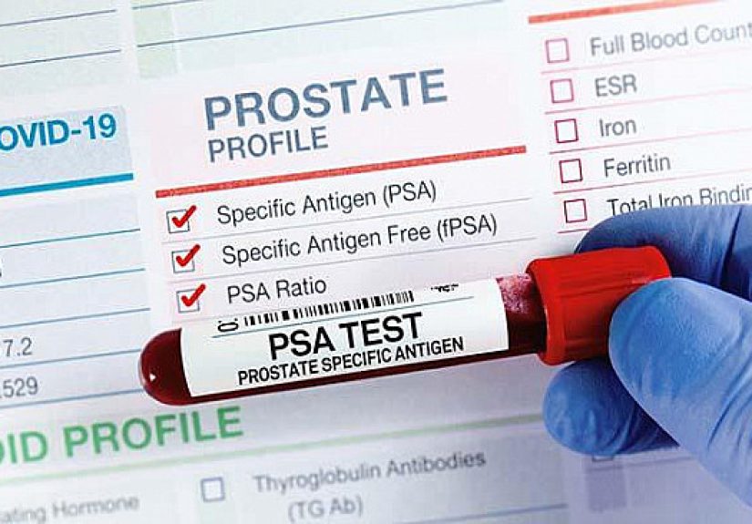 What are the symptoms of prostate cancer? - Harvard Health