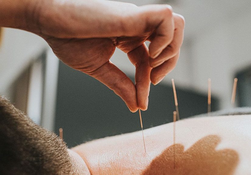 Acupuncture for Diabetes: Safety and Benefits