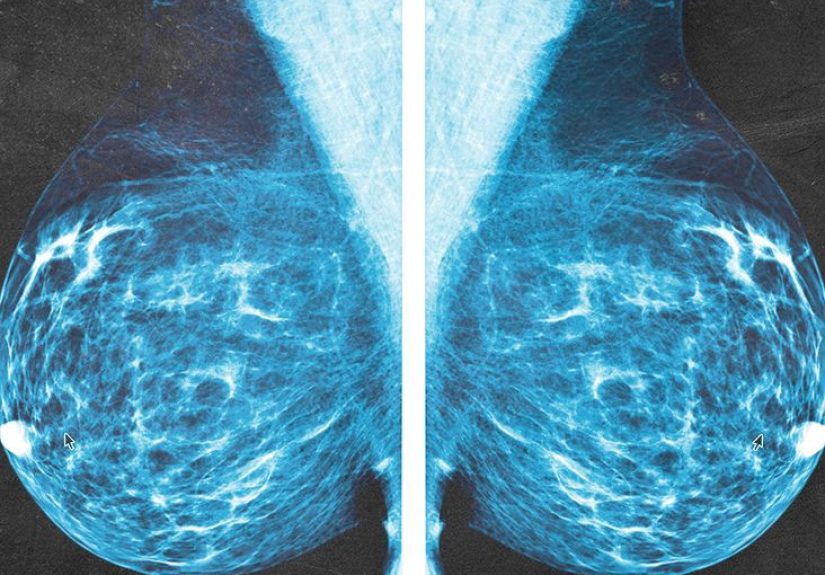Breast anatomy: Functions and how to check for breast cancer