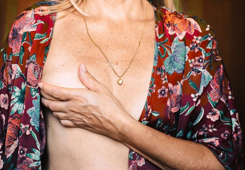 Breast Reconstruction Surgery Options After Cancer Treatment