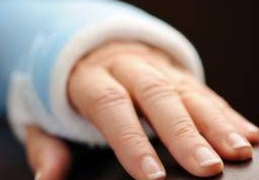 Compartment Syndrome: Causes, Symptoms, and Treatment