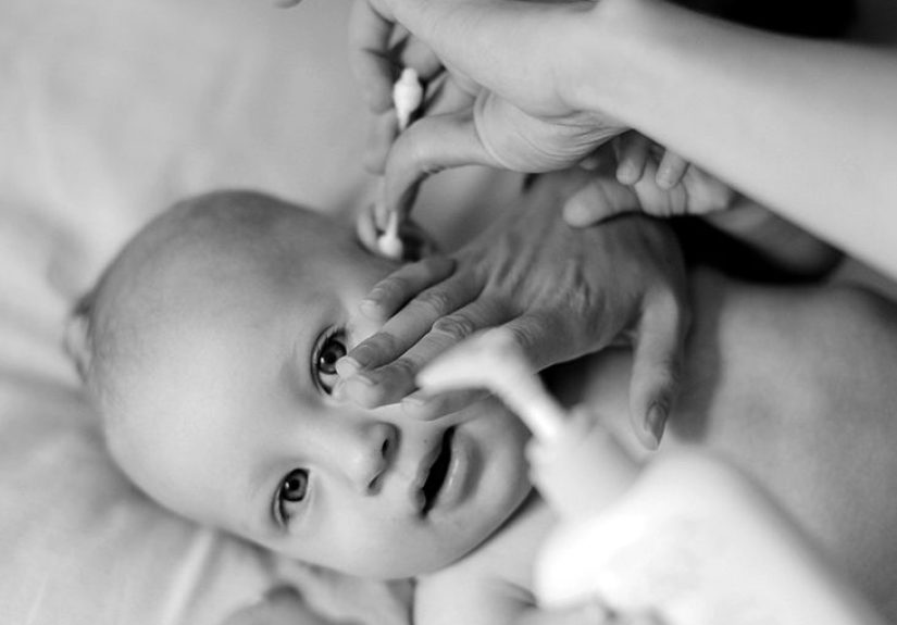 Ear eczema: Symptoms, causes, and treatment