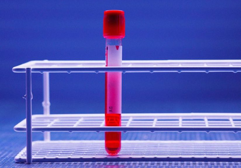How is HIV transmitted? Facts, risk factors, and prevention