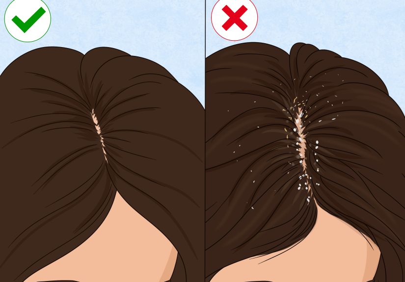 How Often Should You Wash Short Hair? Tips for Keeping Your Hair Healthy and Clean