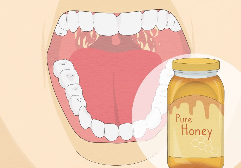 How to Make Natural Antibiotics from Common Ingredients