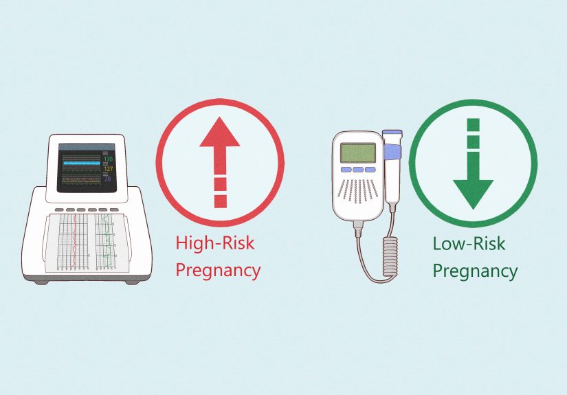 How to Read a Contraction Monitor During Labor