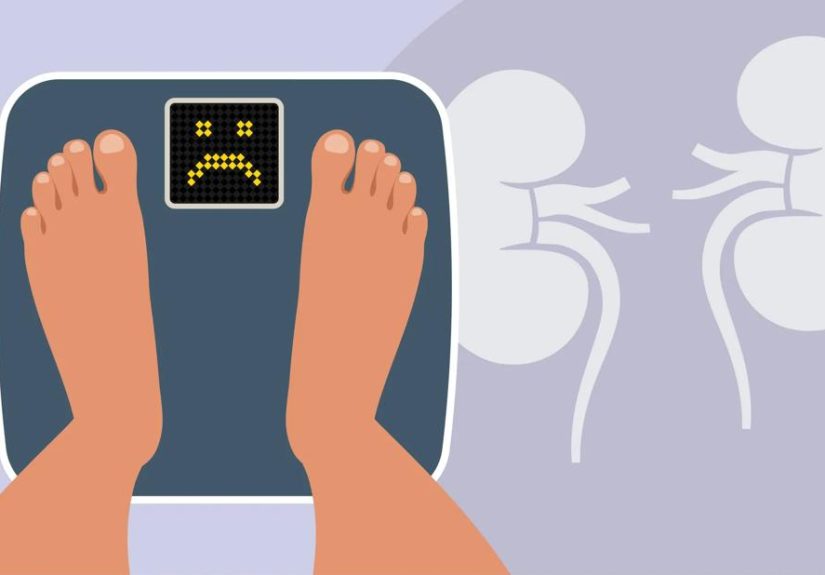 Obesity and Chronic Kidney Disease Connection